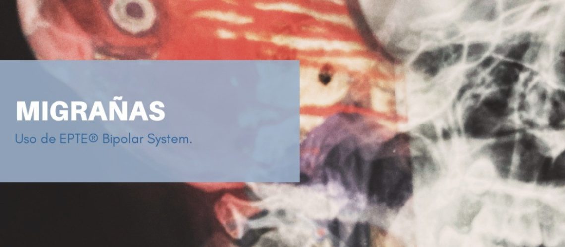 MIGRAÑAS