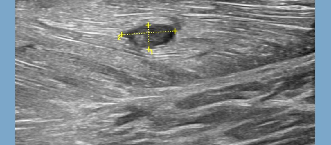 WhatsApp Image 2022-10-06 at 17.33.39