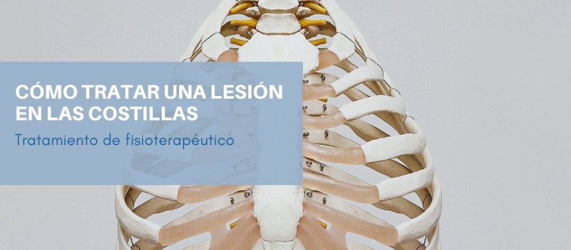 FRACTURA COSTILLAS