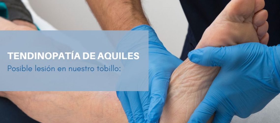 TENDINOPATIA AQUILES